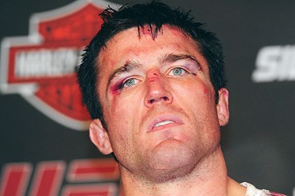 Dana White: Chael Sonnen is in Full Camp, Ready to Fight Jon Jones at UFC 152