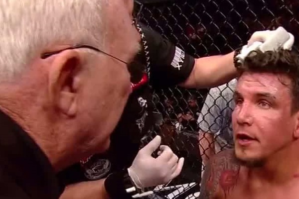 Strikeforce: Frank Mir Injured, out of November Fight with Daniel Cormier