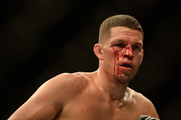 Manager: Nate Diaz Won’t Respond to Diego Sanchez After ‘Retarded’ Judges Decision