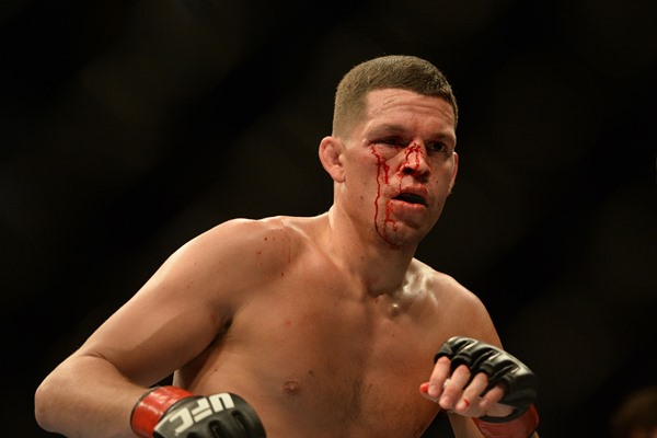 Nate Diaz Slams Donald Cerrone, Dana White Tells Off Diaz 