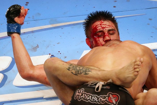 Malki Kawa: Carlos Condit Will Accept Rory MacDonald Rematch if Offered